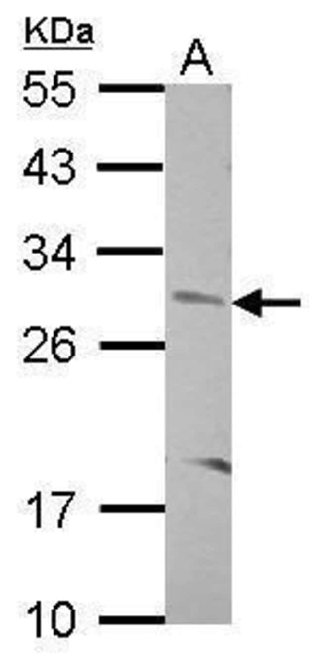 ANTI-CNOT8