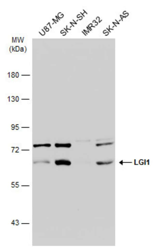 ANTI-LGI1