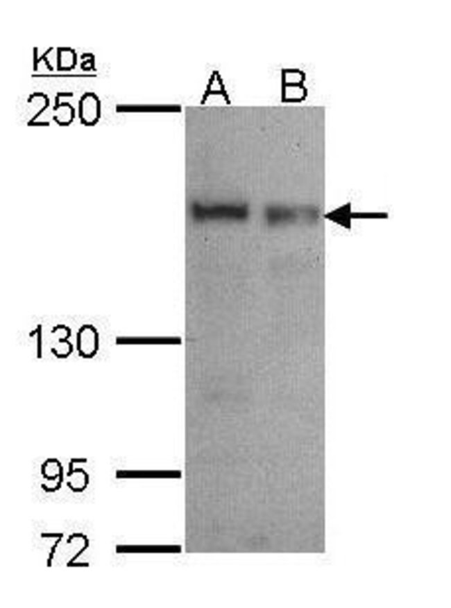 ANTI-SEC31A