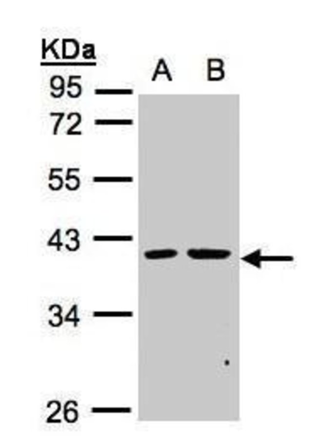 ANTI-PSKH2