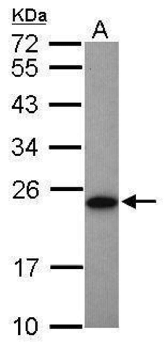 ANTI-ADENYLATE KINASE 1