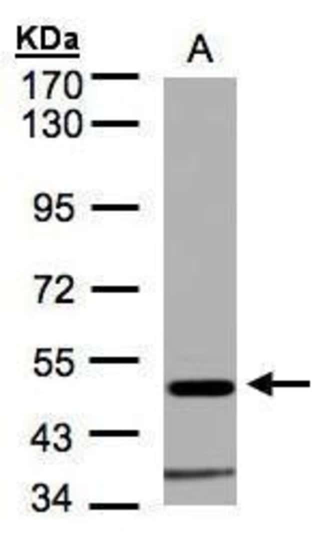 ANTI-GLYCINE RECEPTOR ALPHA1