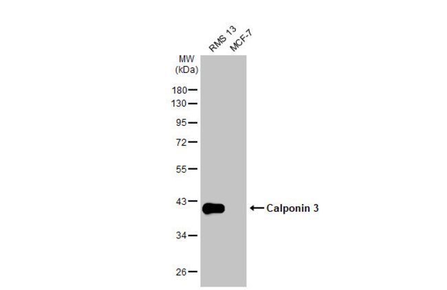 ANTI-CALPONIN 3