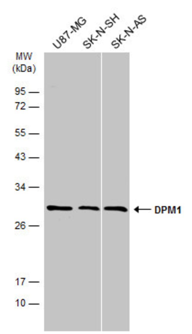 ANTI-DPM1