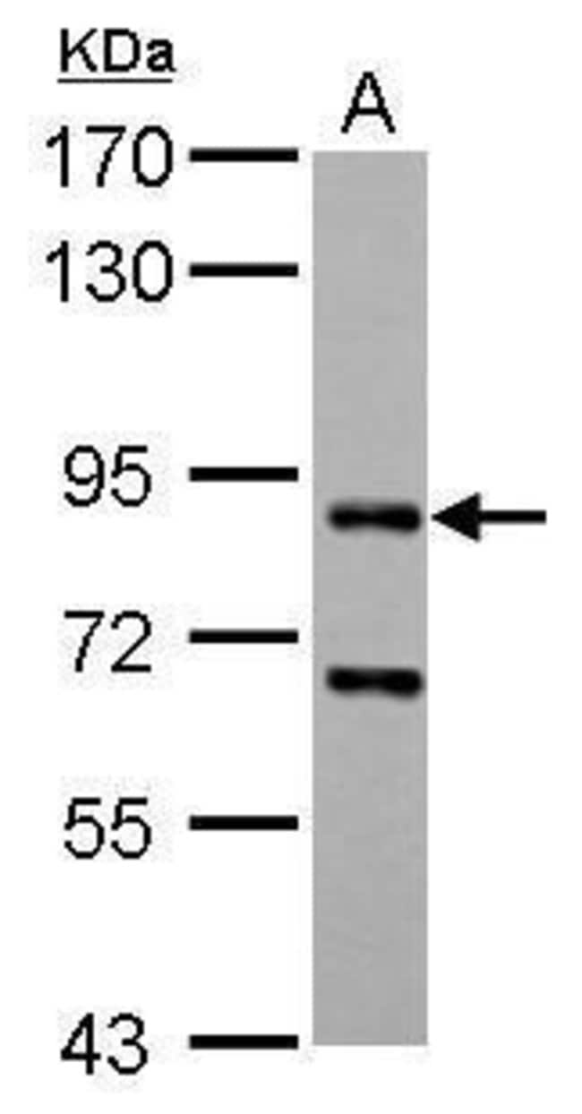 ANTI-CD2AP