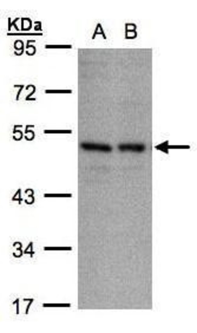 ANTI-CD158E