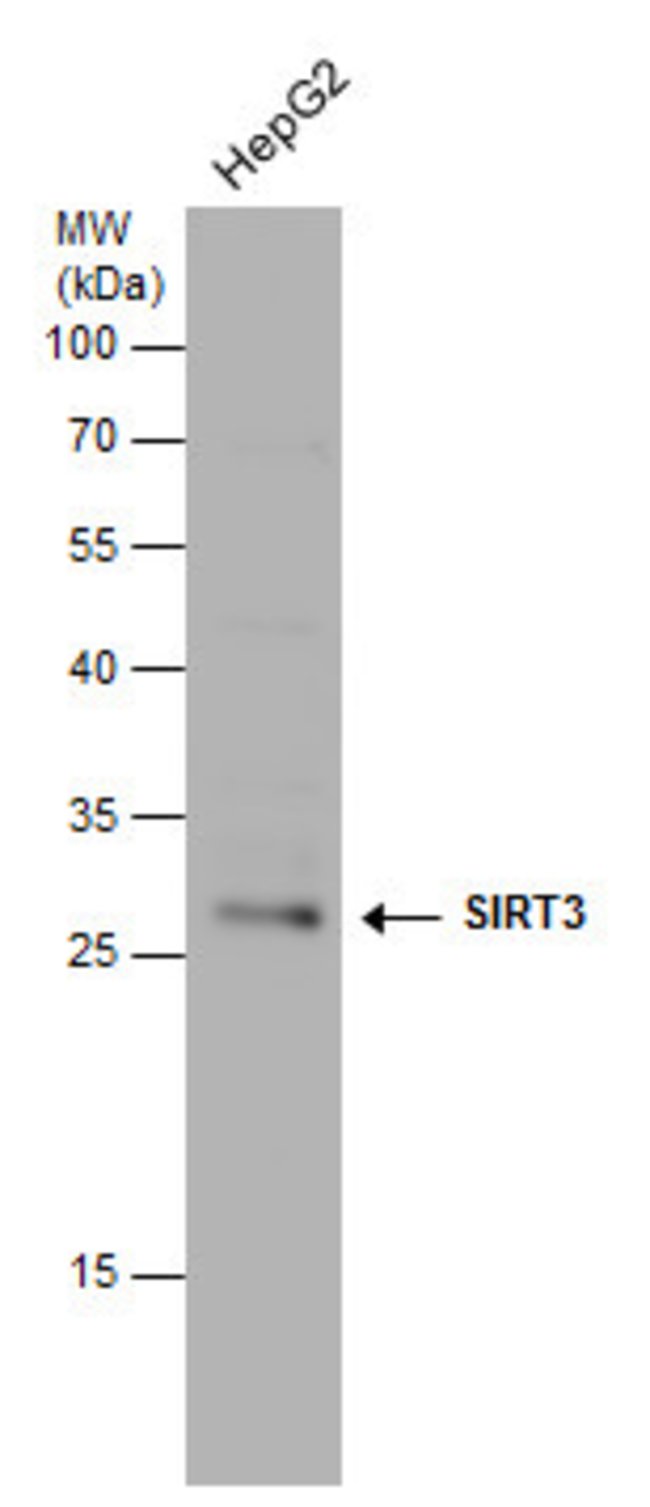 ANTI-SIRT3