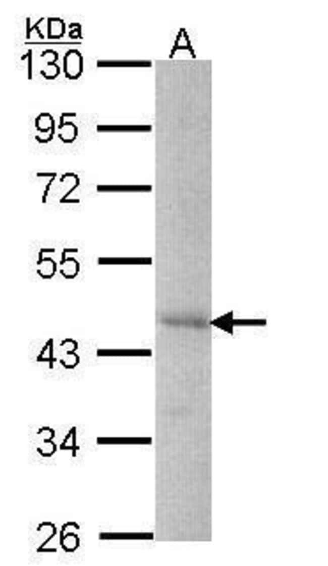 ANTI-DYX1C1