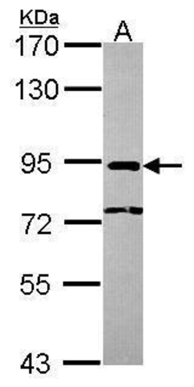 ANTI-NCBP1