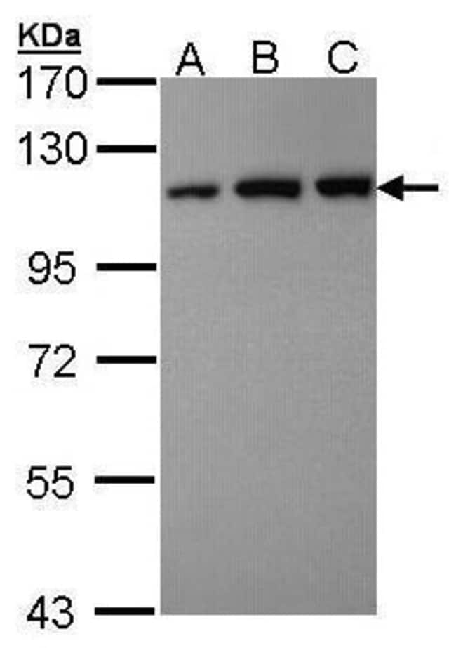 ANTI-VDP/P115