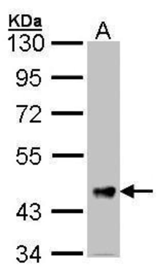 ANTI-FSTL1