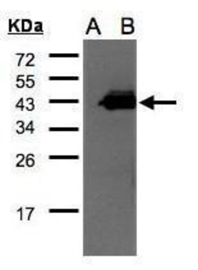 ANTI-CCNDBP1