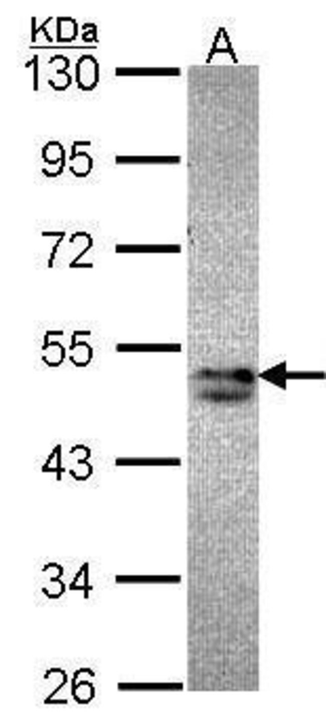 ANTI-SORTING NEXIN-15