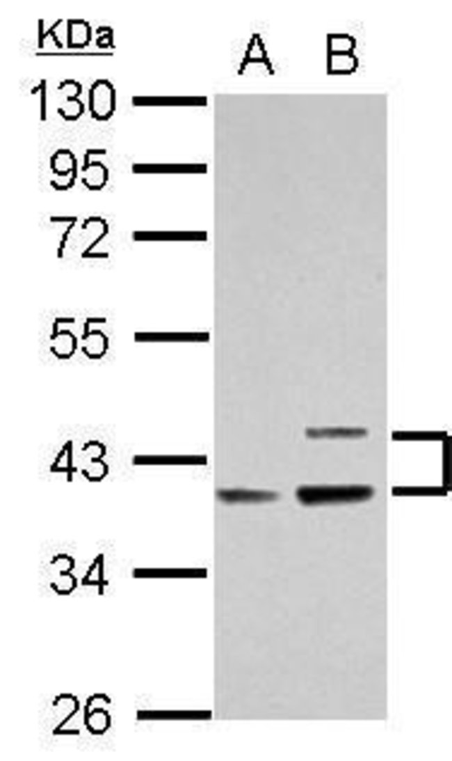 ANTI-APOLIPOPROTEIN L1