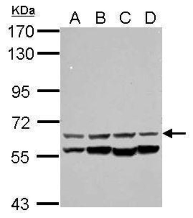 ANTI-CESK1