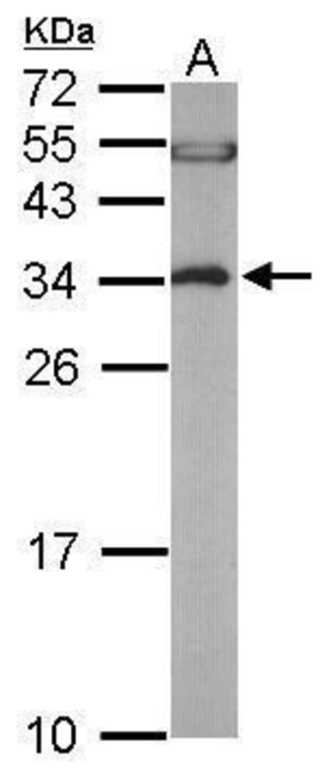 ANTI-EEF1B2