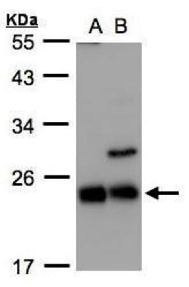 ANTI-PEBP2BETA