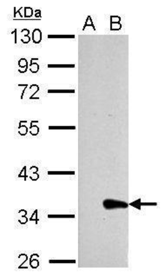 ANTI-GALECTIN 8