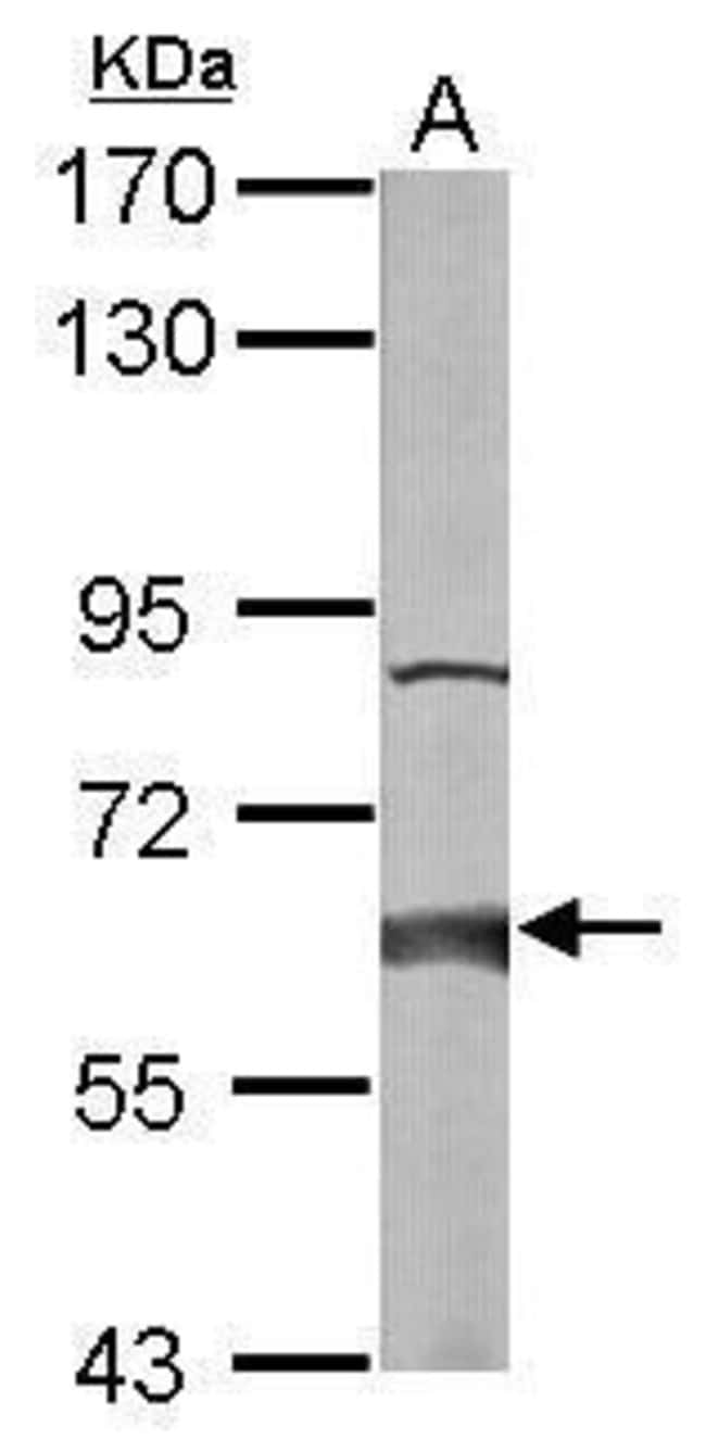 ANTI-HACL1