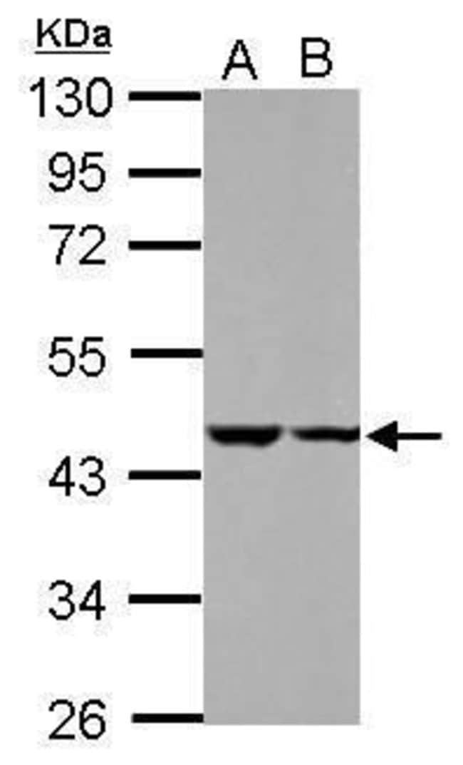 ANTI-C18ORF25