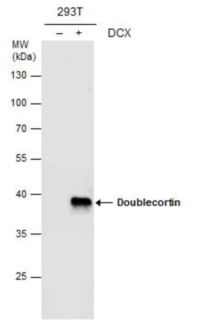 ANTI-DOUBLECORTIN