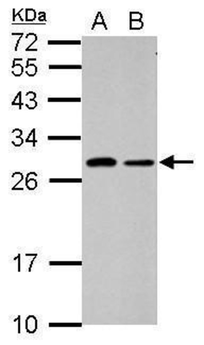 ANTI-C1ORF111