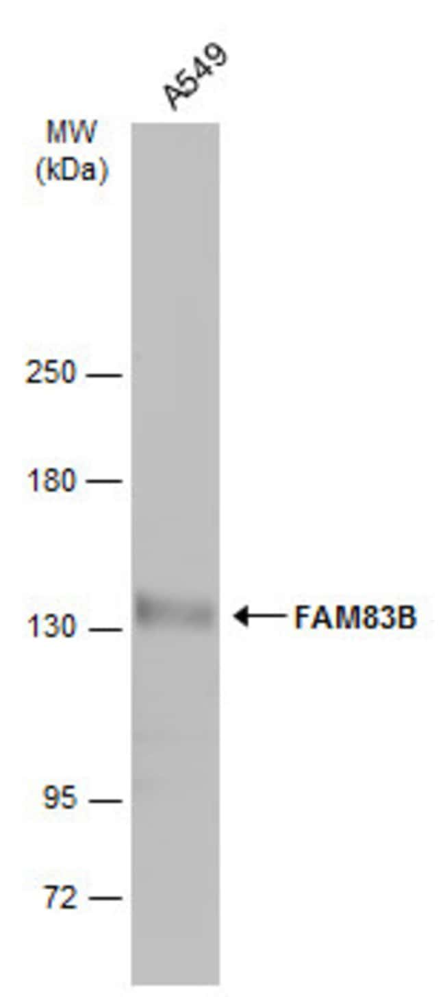 ANTI-FAM83B