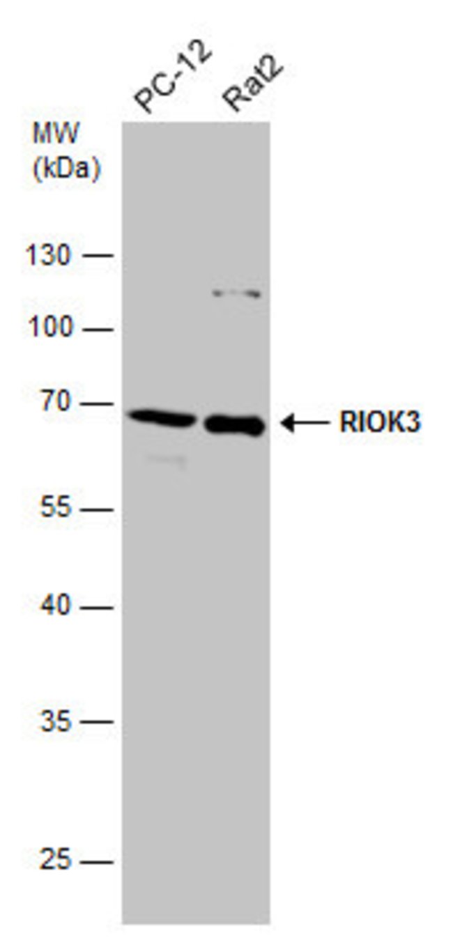 ANTI-RIOK3