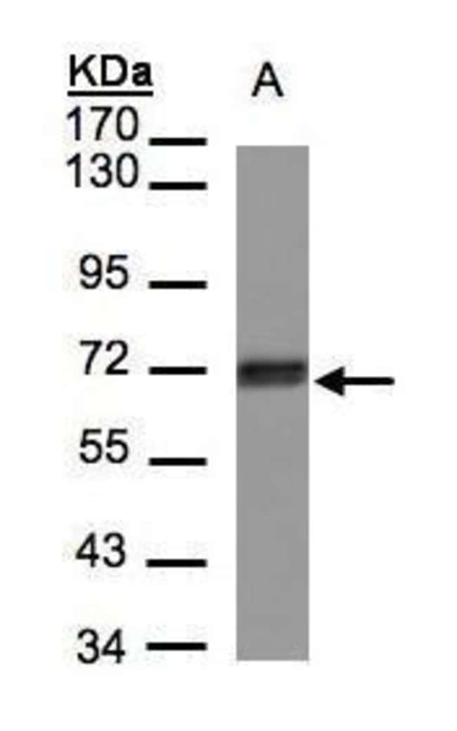 ANTI-CCDC6