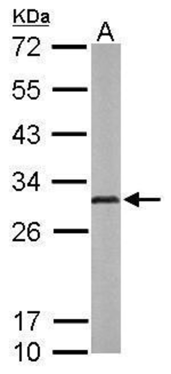 ANTI-ADENYLATE KINASE 2