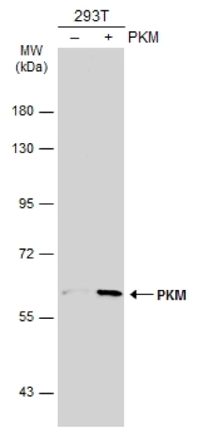 ANTI-PYRUVATE KINASE (MUSCLE)