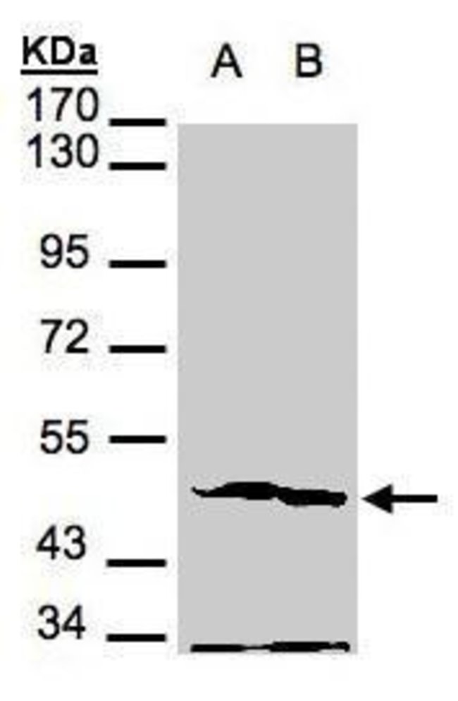 ANTI-PHOSPHOGLYCERATE KINASE 2