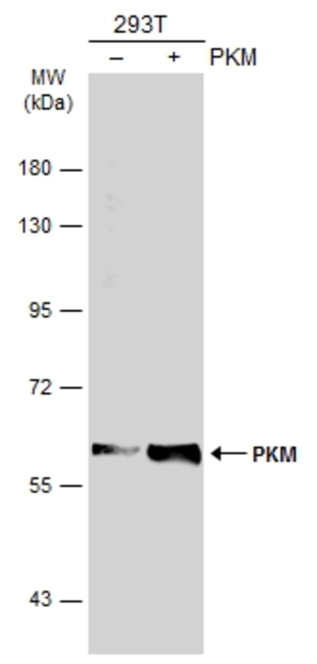 ANTI-PYRUVATE KINASE (MUSCLE)