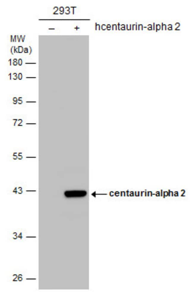 ANTI-CENTAURIN-ALPHA 2