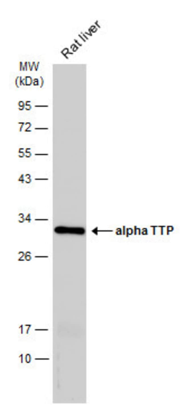 ANTI-ALPHA TTP