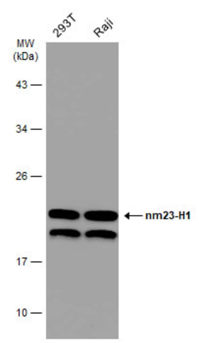 ANTI-NM23-H1