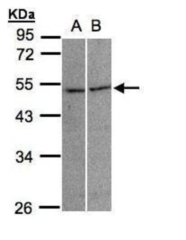 ANTI-GLYCINE RECEPTOR ALPHA 3