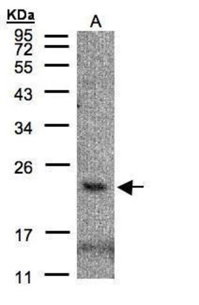 ANTI-CMTM3