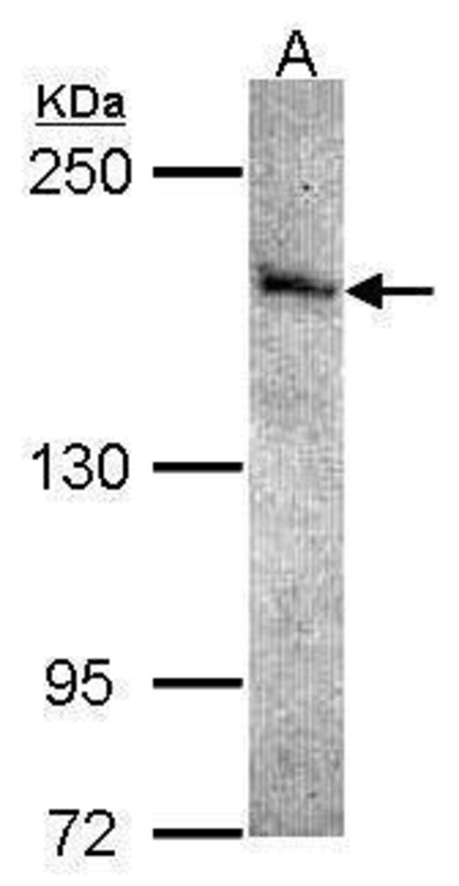 ANTI-STK36