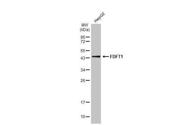 ANTI-SQUALENE SYNTHETASE(SQS)