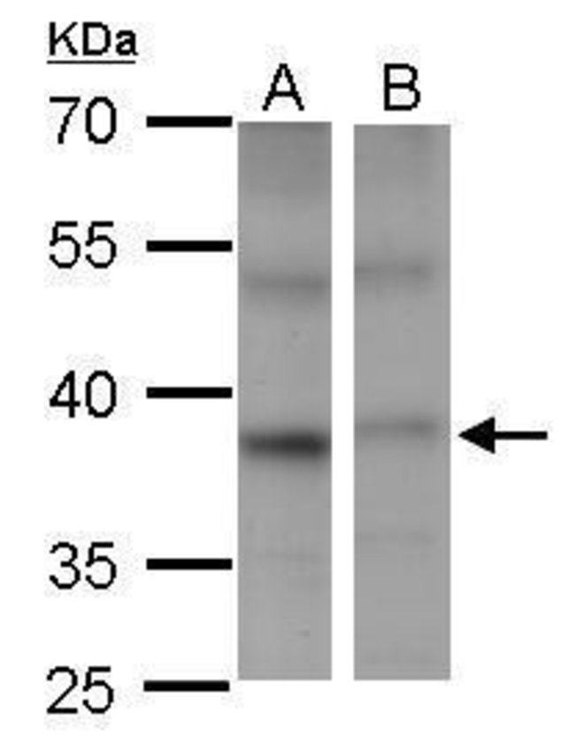 ANTI-PSTPIP2