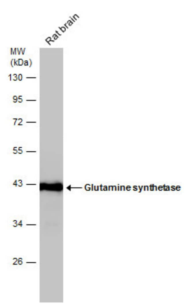 ANTI-GLUTAMINE SYNTHETASE