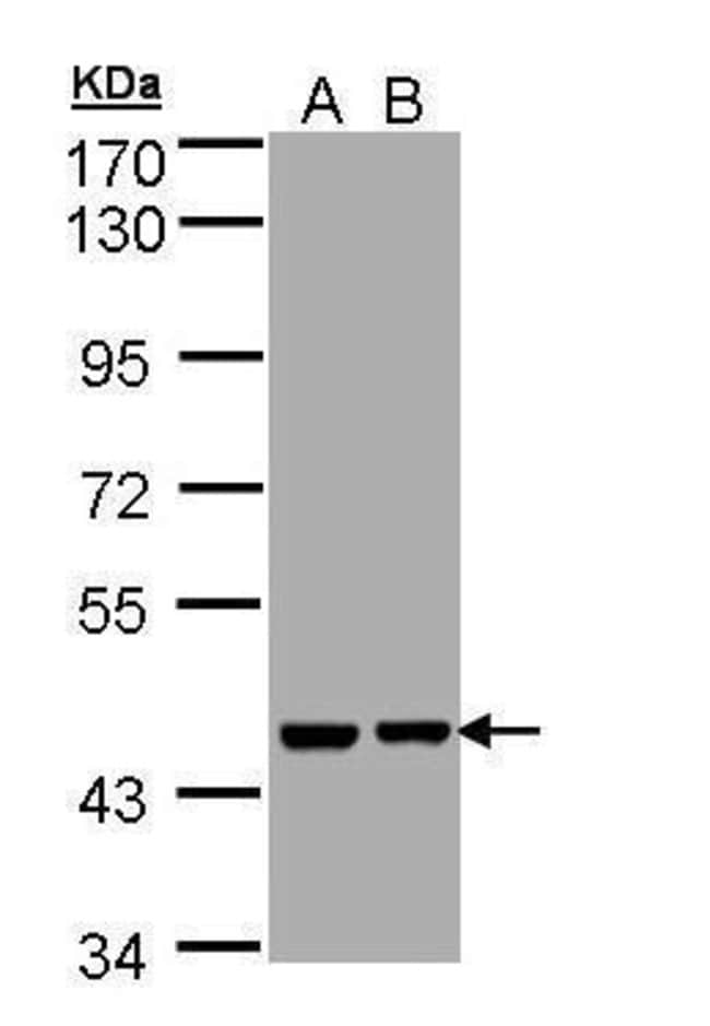 ANTI-APRATAXIN