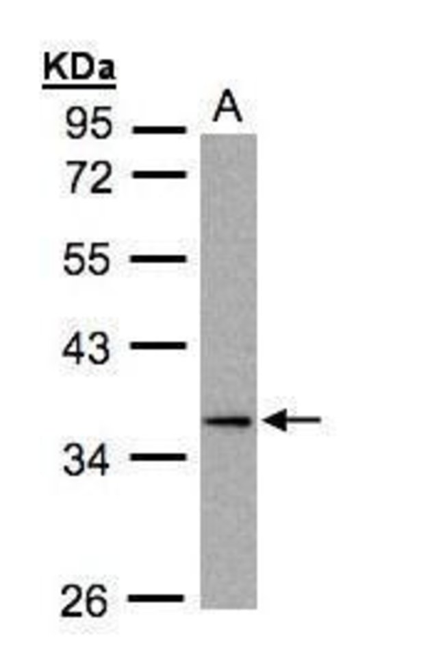 ANTI-MKP-4