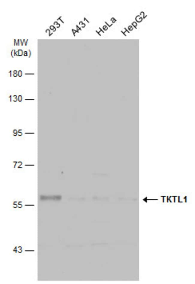 ANTI-TKTL1