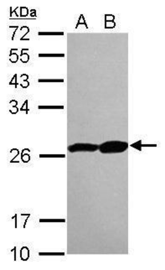 ANTI-PROTEASOME 20S BETA 3