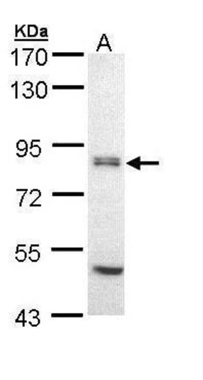 ANTI-EIF2B EPSILON