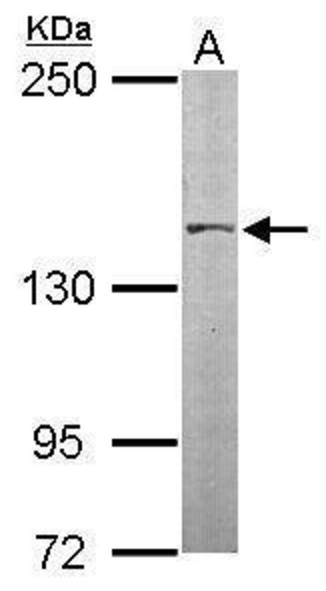 ANTI-SMC3