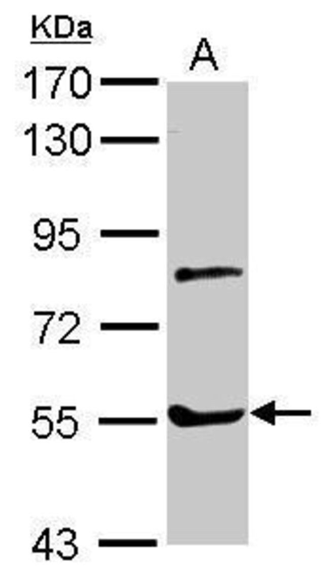 ANTI-MYOTILIN