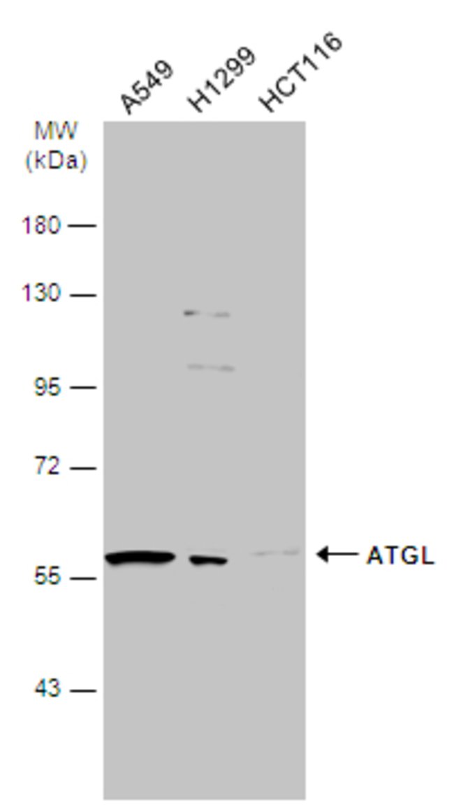 ANTI-PNPLA2